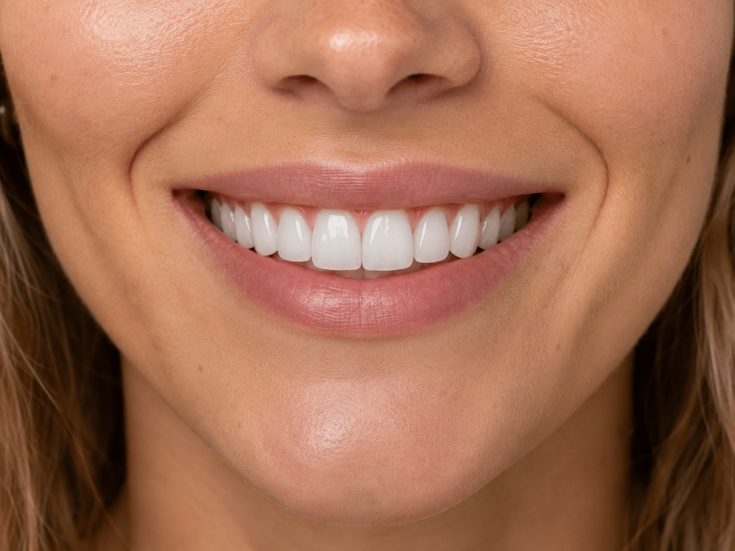 Front-on close-up of a broad, natural smile showing the seven features of good smile design